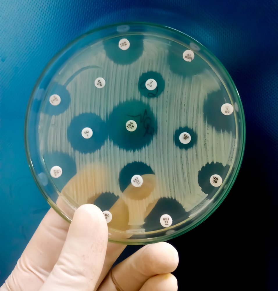 Antimicrobial susceptibility testing in petri dish.